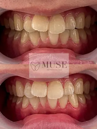 セルフホワイトニングサロンMUSE所属・セルフホワイトニング MUSE🫧焼津のその他イメージ