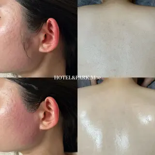 HOTEL&PARK .Moeワックス脱毛のエステ・リラクイメージ