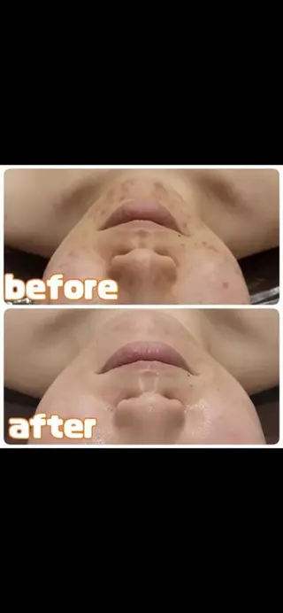 🧸レイビス💕 sora🧸のエステ・リラクイメージ