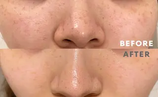 エステと焼き菓子 レモンバームソワンのエステ・リラクイメージ