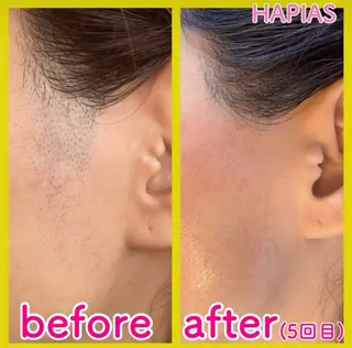 staff 山本のエステ・リラクイメージ