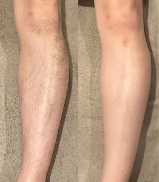 oui-oui　ウィウィ所属・oui-oui 磐田脱毛のエステ・リラクイメージ