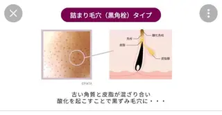 夏までに肌荒れ卒業 するサロン🌻のエステ・リラクイメージ