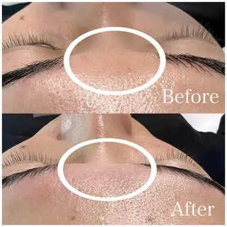 アイブロウ ハリウッド ブロウリフト専門店の眉毛・アイブロウイメージ