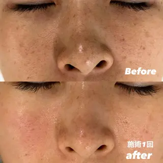 豊田 明里のエステ・リラクイメージ