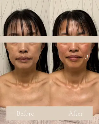 Lani Moon所属・⟡ 京都 小顔  ⊹ Lani Moonのエステ・リラクイメージ