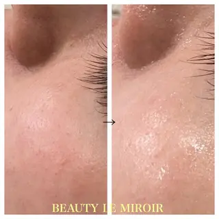 ビューティー ミロワールのエステ・リラクイメージ