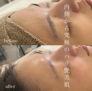 blan. beauty salon所属・blan. /岡本/ 神戸ハーブピーリングのエステ・リラクイメージ