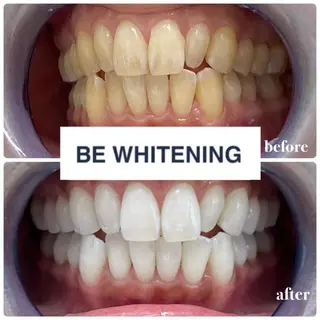 ホワイトニング専門店 ビーホワイト金山のその他イメージ