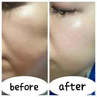 よもぎ蒸しサロン ruiangeのエステ・リラクイメージ