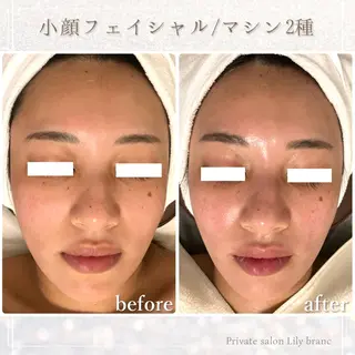 Lily branc 痩身/小顔/肌質改善のエステ・リラクイメージ