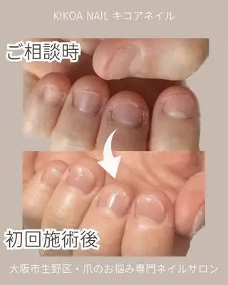 ネイル KIKOA NAIL キコアネイルのネイルデザイン