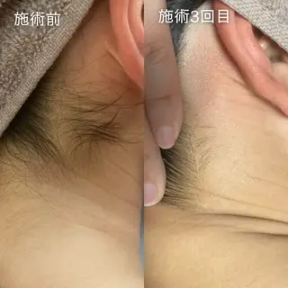 OWL TOTAL BEAUTY SALON所属・OWL 脱毛&バストケアのその他イメージ