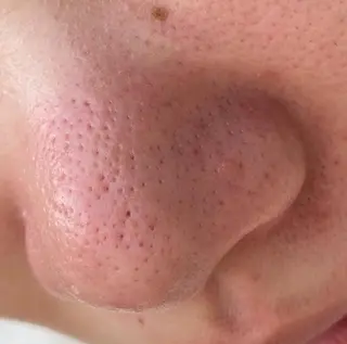 Ummi所属・肌管理／眉毛．まつ毛 陽子の眉毛・アイブロウイメージ