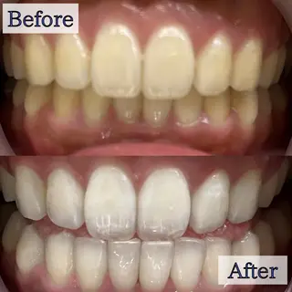 LBSホワイトニング 🌐渋谷店 小河原のエステ・リラクイメージ