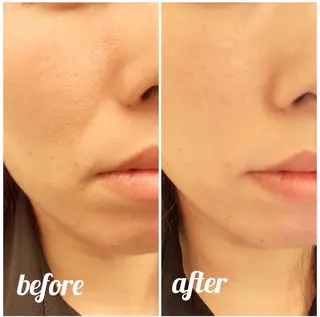 MORE BEAUTY ESTHE 本通り店所属・more ‎‪𓍯 ‬のエステ・リラクイメージ