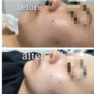 🅖🅤🅩🅔🅛 salonのエステ・リラクイメージ