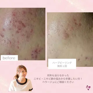 ベラージュ【美背中・ 美尻・フェイシャル】のエステ・リラクイメージ