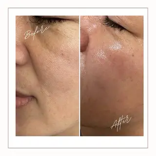 La-myu所属・藤川 由佳のエステ・リラクイメージ