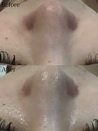 beautysalon LIMOA所属・松本 愛絵理のエステ・リラクイメージ