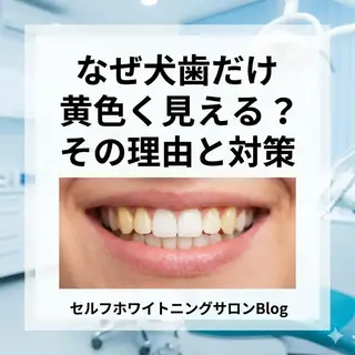 マツエク・マツパ ホワイトニングサロン nico西葛西店のその他イメージ