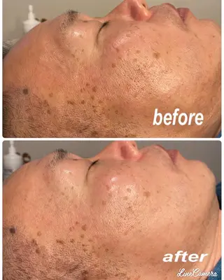 メンズ salon Sunny所属・脱毛salon Sunnyのエステ・リラクイメージ