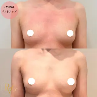 beautysalon RAVIS所属・東大阪/韓国肌管理/ 痩身バスト専門店のエステ・リラクイメージ