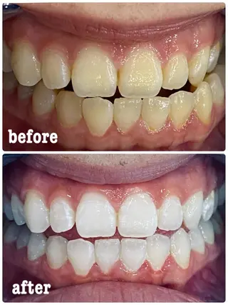 ホワイトニングサロン ラウレアのその他イメージ