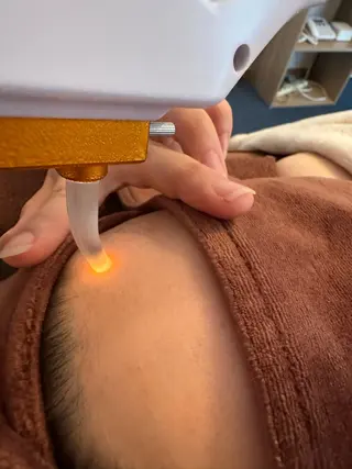 美容鍼・脱毛サロン Callaのエステ・リラクイメージ