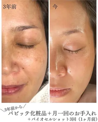 エステ／ネイル/脱毛 R.Msalonのネイルデザイン