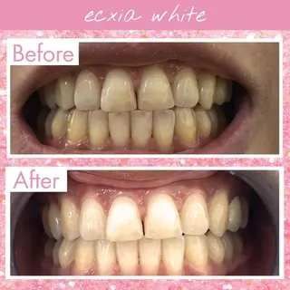 セルフホワイトニング エクシア新百合ヶ丘店のその他イメージ