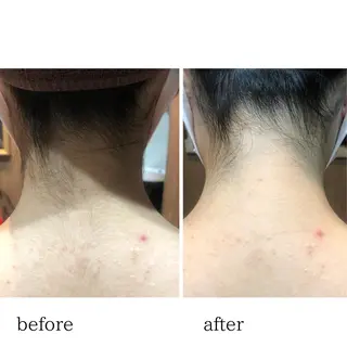 Naps-Shaving所属・新宿シェービング専門 Napsの眉毛・アイブロウイメージ