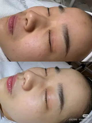 マツエク・マツパ aliaハイフ&水光ジェットサロン所属・aliaハーブ水光店 エステティシャン募集のエステ・リラクイメージ