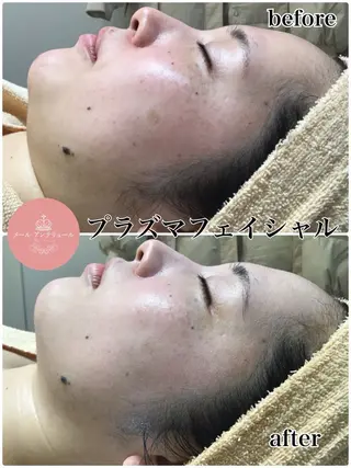 メールアンテリュール 佐野のエステ・リラクイメージ