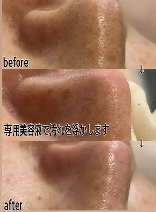 aroma  YURARI所属・韓国艶美人// 毛穴ケア🌹のエステ・リラクイメージ