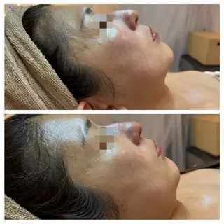 肌質改善フェイシャルCLEAR栄生/リンパ/毛穴/シミケア所属・井戸 麻衣のエステ・リラクイメージ