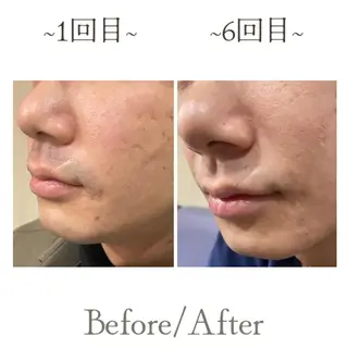 メンズサロンGRACE所属・salon GRACEのエステ・リラクイメージ