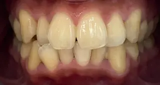 セルフホワイトニングサロン　ラヴィアン所属・ホワイトニングサロン La vie enのその他イメージ