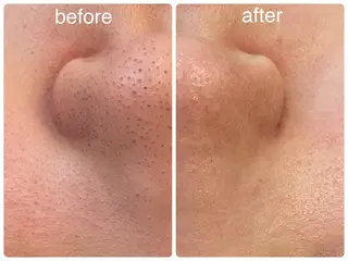 Hisui 小出のエステ・リラクイメージ