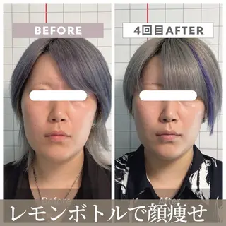 【小顔リフト×小顔矯正専門店】RED所属・猿渡 ひかるのエステ・リラクイメージ