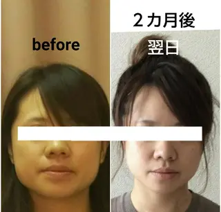 小顔と美肌 まごころエステMatoria所属・小顔 美肌専門 Matoriaのエステ・リラクイメージ