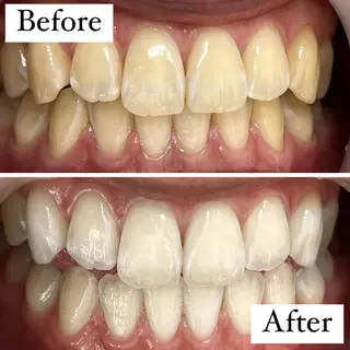 LBSホワイトニング 🌐渋谷店 小河原のエステ・リラクイメージ