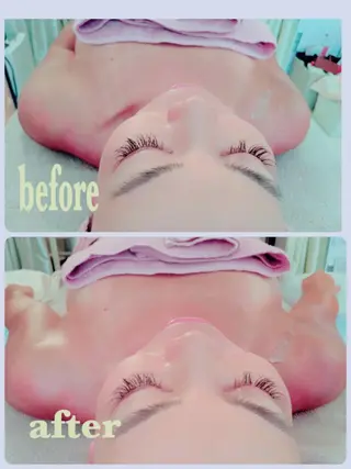 private salon  Dea_maris シュガーリング＆パーソナルボディケア所属・シミ改善・韓国肌管理 ボディメイク痩身のその他イメージ