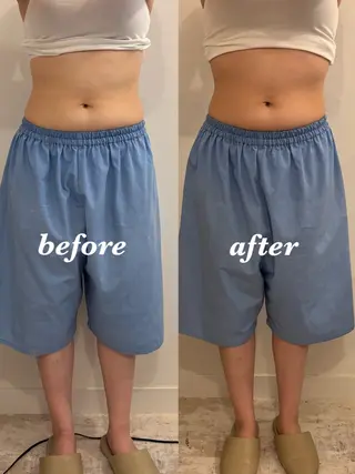 腸活サポート みなみののエステ・リラクイメージ