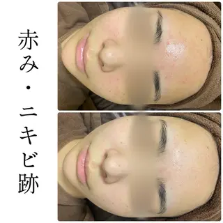 ハーブピーリング専門 BIOEL横浜のエステ・リラクイメージ