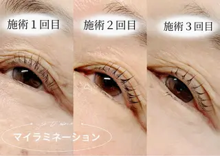 マツエク・マツパ Bruges 自由が丘のマツエク・マツパデザイン