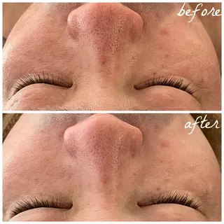 メンズ メナード岐阜市茜部 杉浦のエステ・リラクイメージ