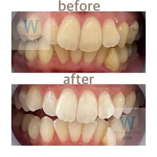 ホワイトニング ショップ船橋店🦷のエステ・リラクイメージ