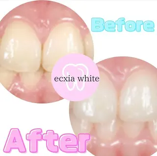 エクシアホワイトニング草津店所属・nanami -ホワイトニングのその他イメージ