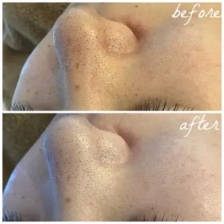 メンズ メナード岐阜市茜部 杉浦のエステ・リラクイメージ